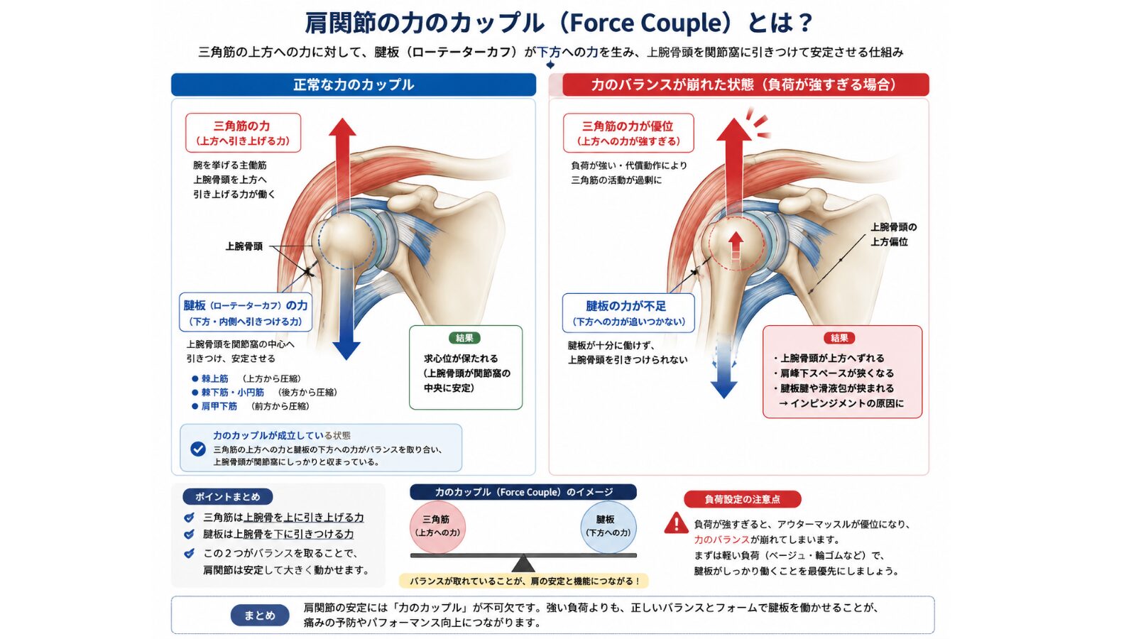 負荷が強すぎることで肩峰下インピンジメントが起こる仕組み