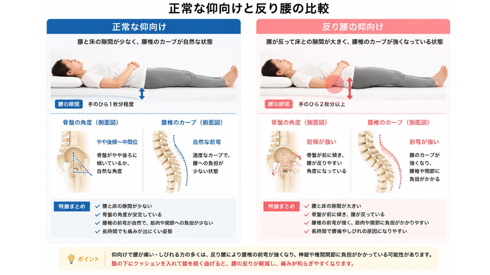 正常な仰向けと反り腰の比較