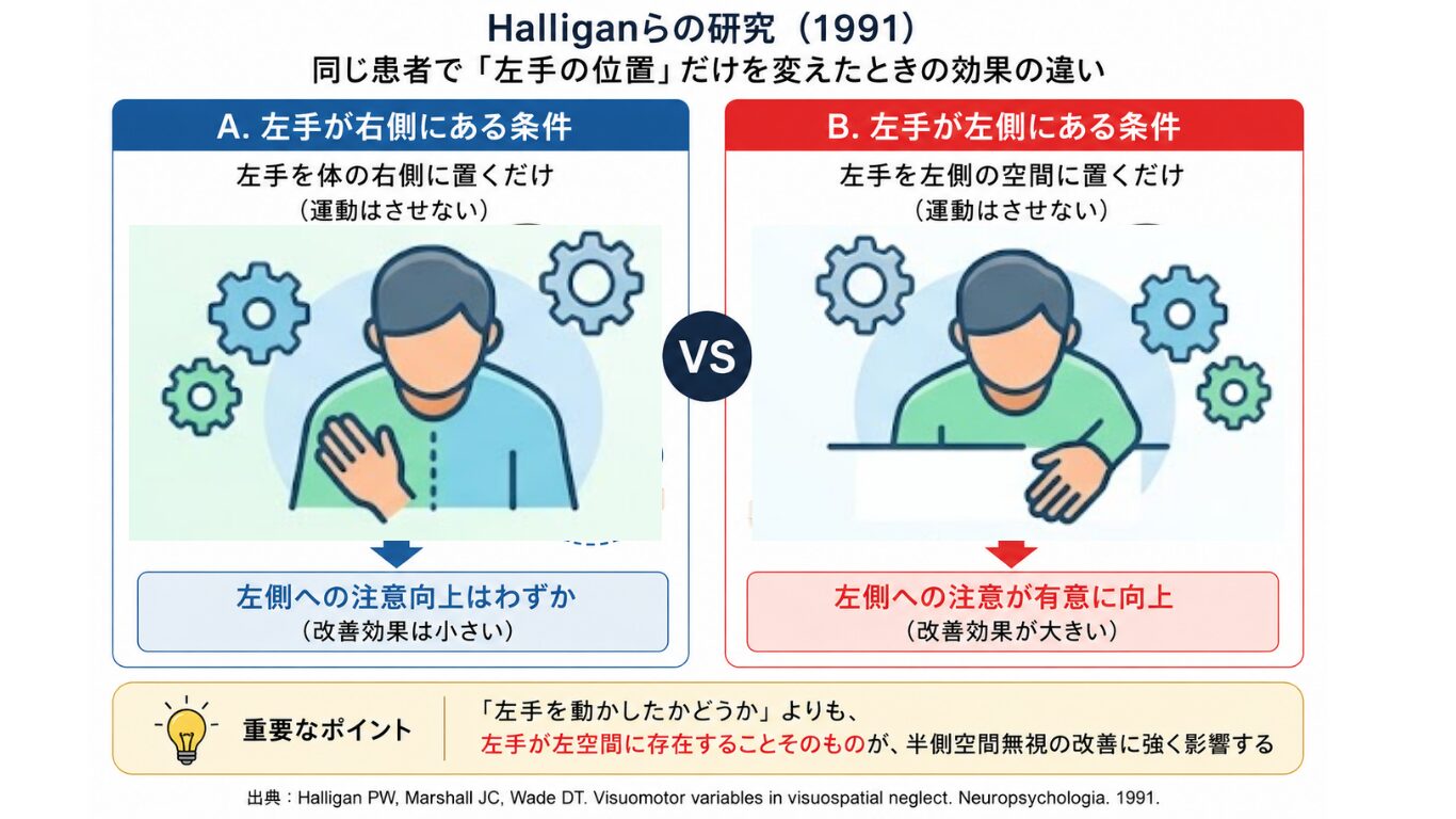左空間における患肢の位置がUSN改善に関与するイメージ