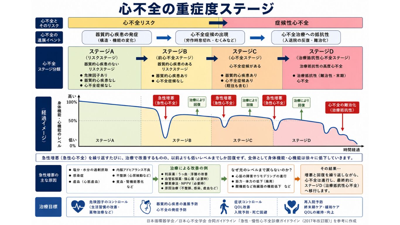 心不全の重症度ステージ Stage A〜D