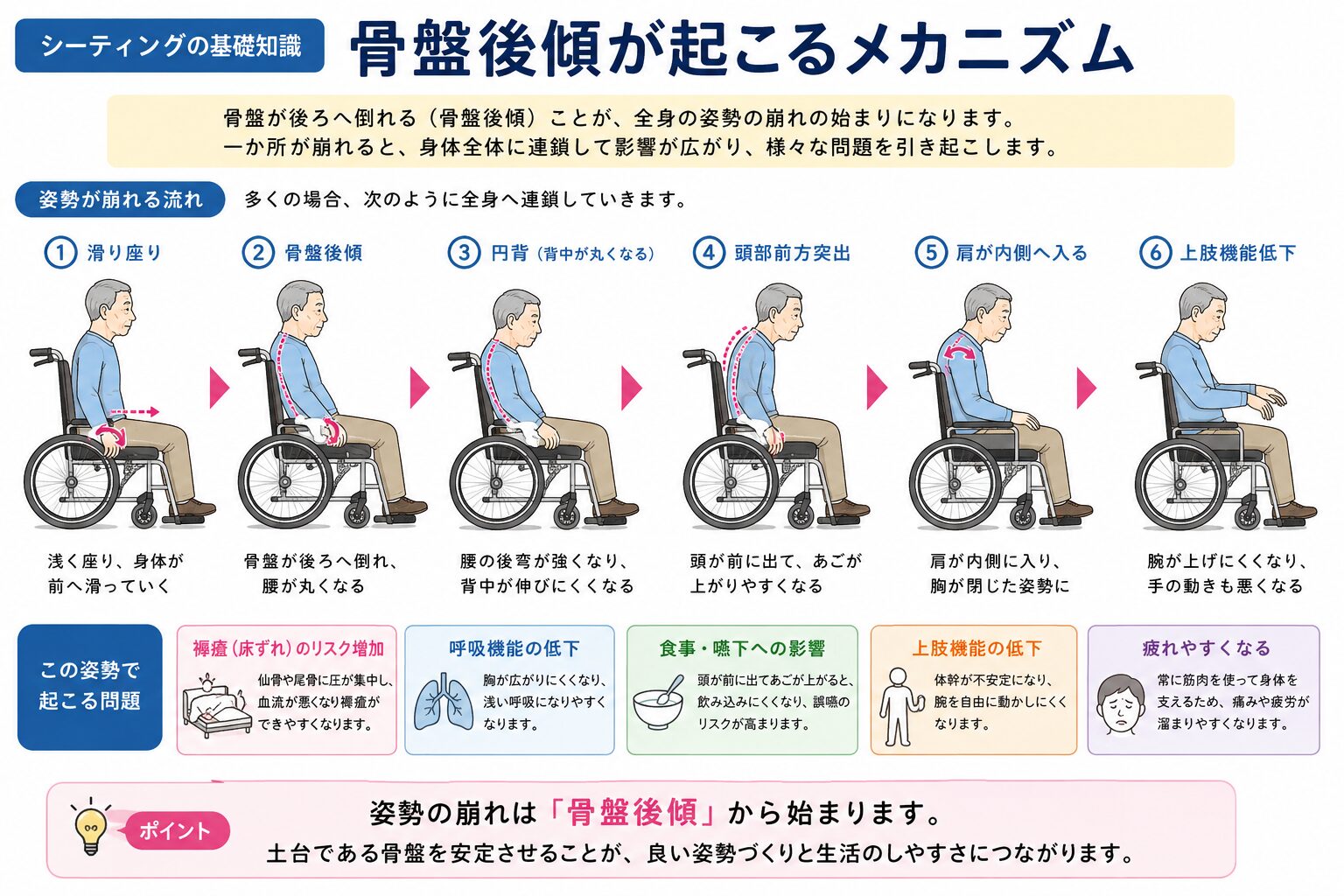 骨盤後傾のメカニズムを示す全身の連鎖図