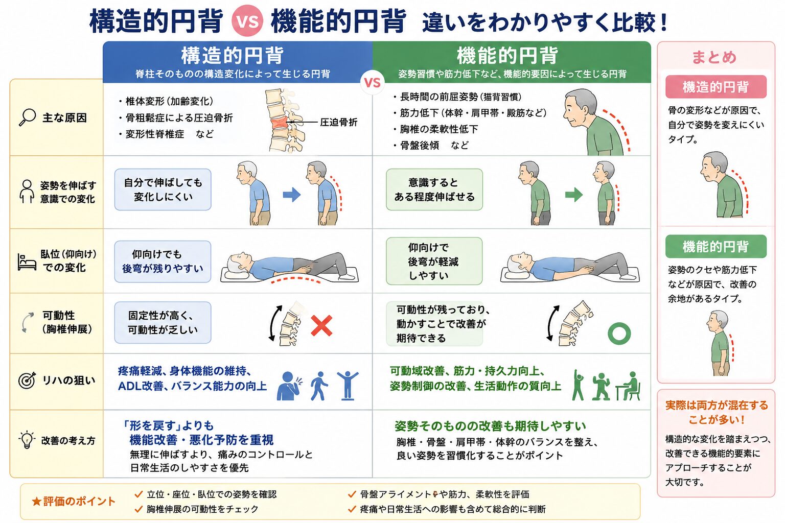 構造的円背と機能的円背の違いを示すイラスト