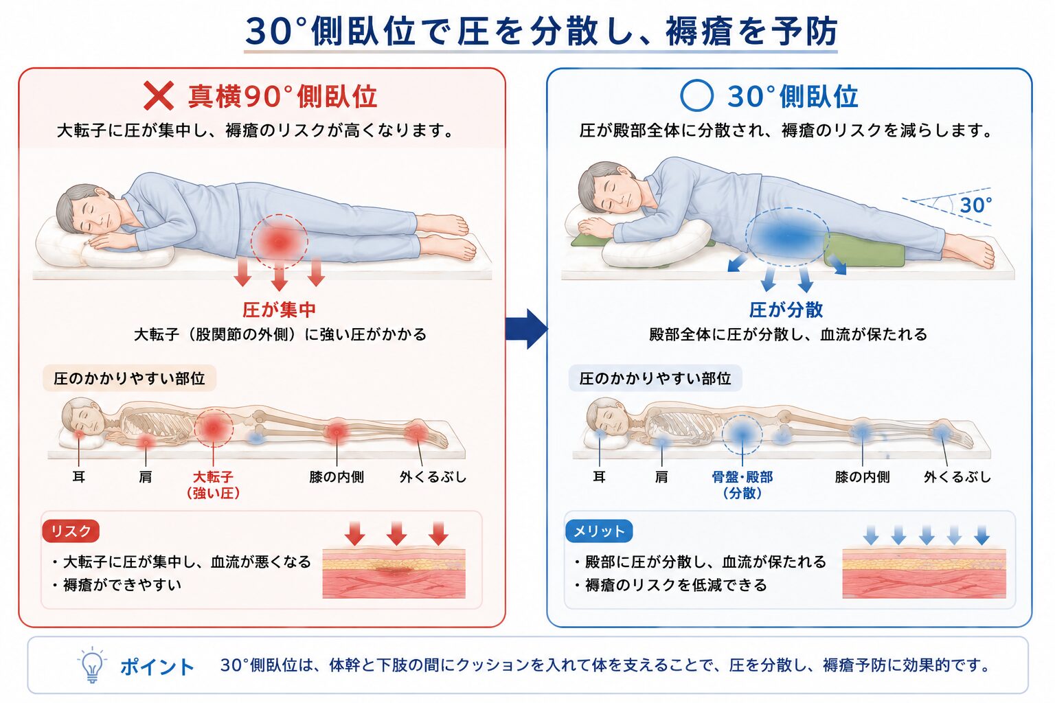褥瘡予防のポイント（体位変換・除圧・ポジショニング・スキンケア・栄養・離床）を示す図
