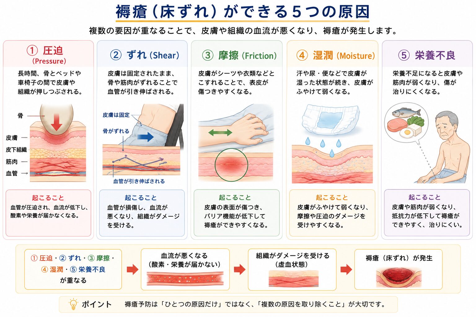 仰向け・横向き・座位・車椅子で褥瘡ができやすい部位を示す図