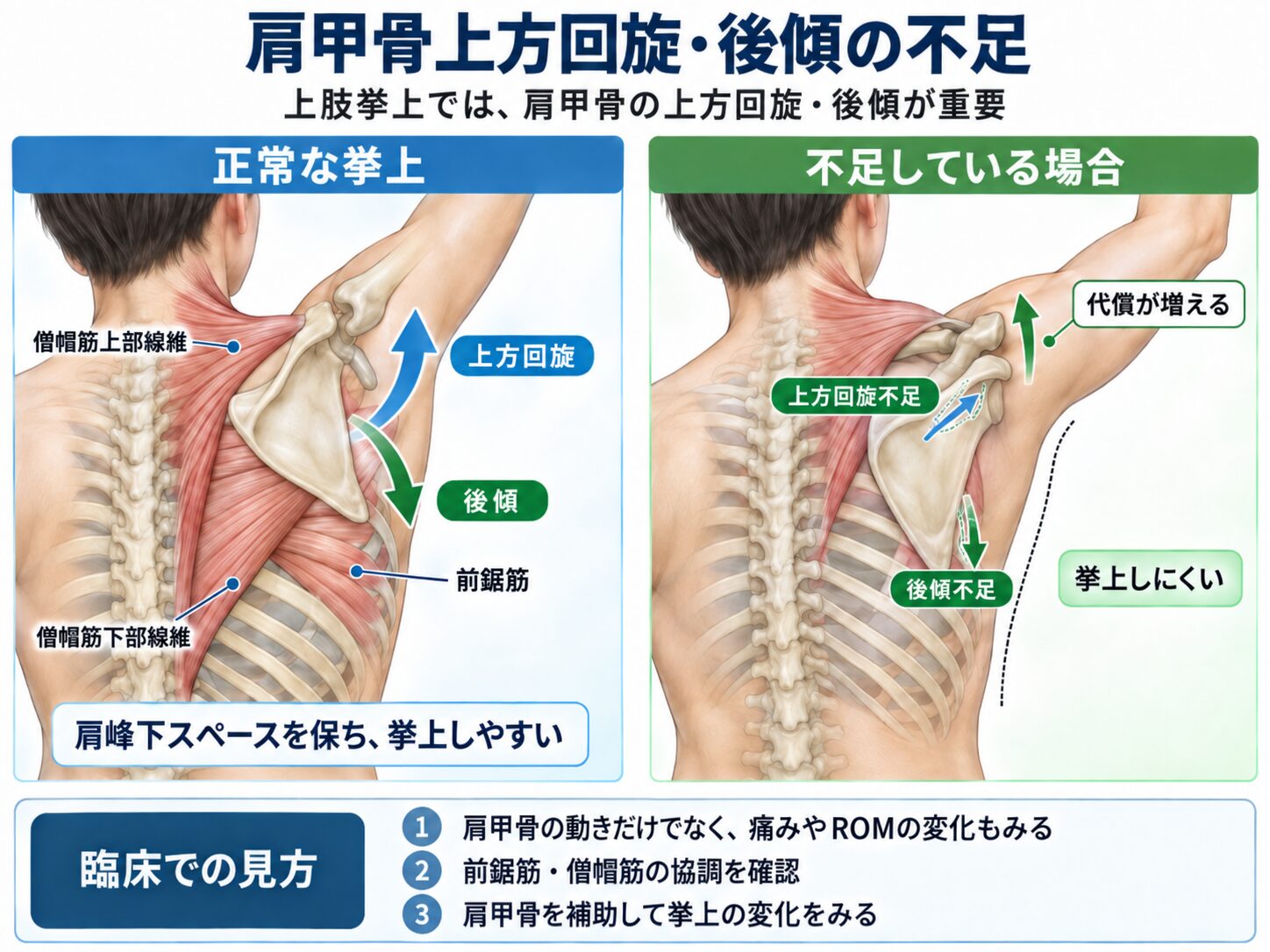 肩甲骨上方回旋・後傾