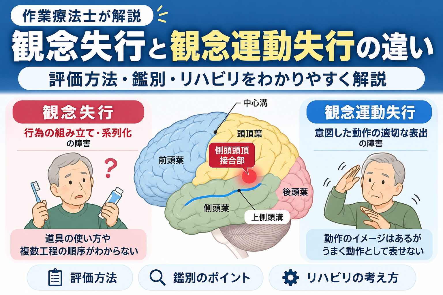 作業療法士が解説】観念失行と観念運動失行の違い｜評価方法・鑑別