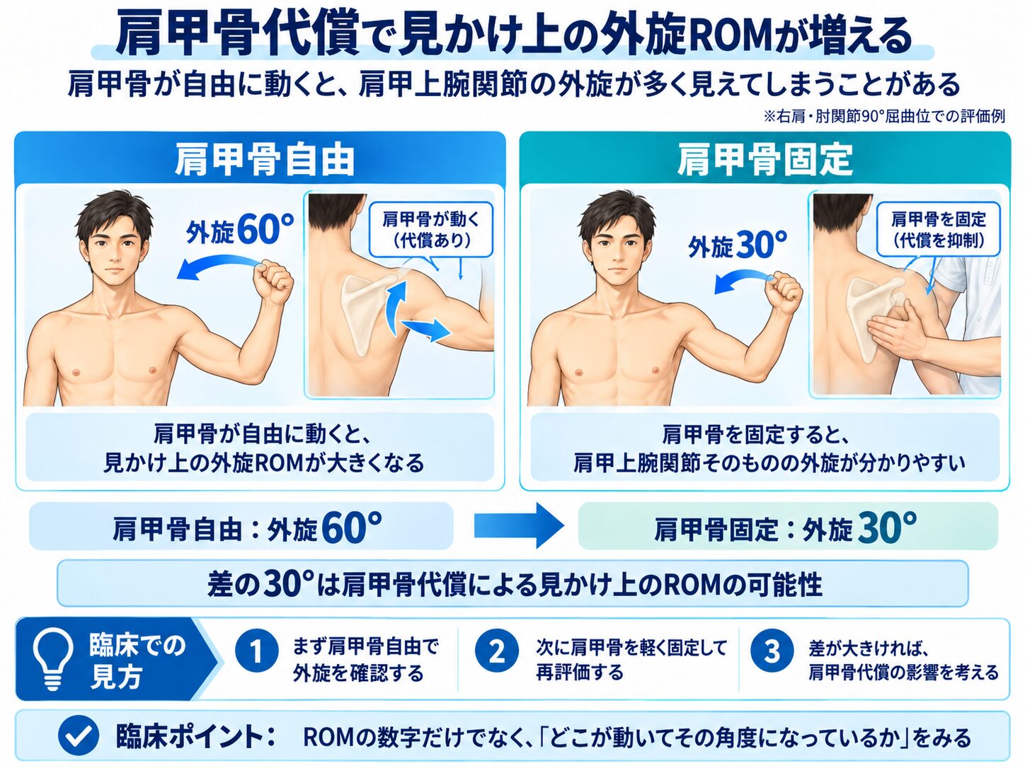 肩甲骨代償