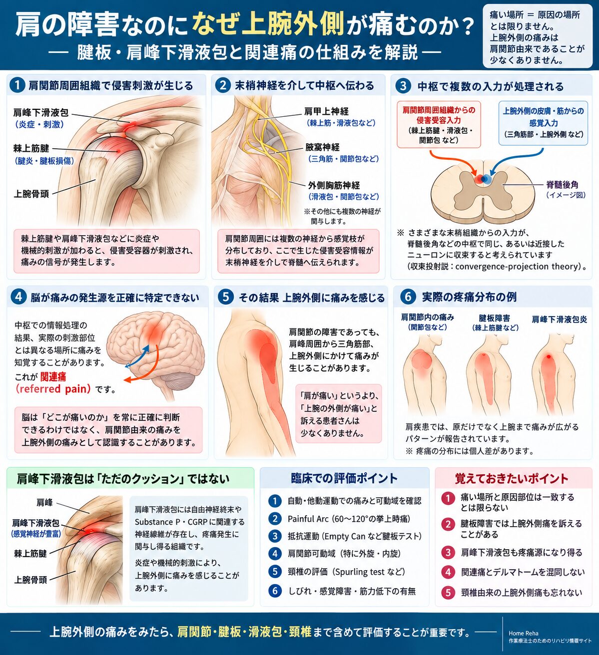 肩関節由来の痛みが上腕外側の関連痛として現れるメカニズムの図解