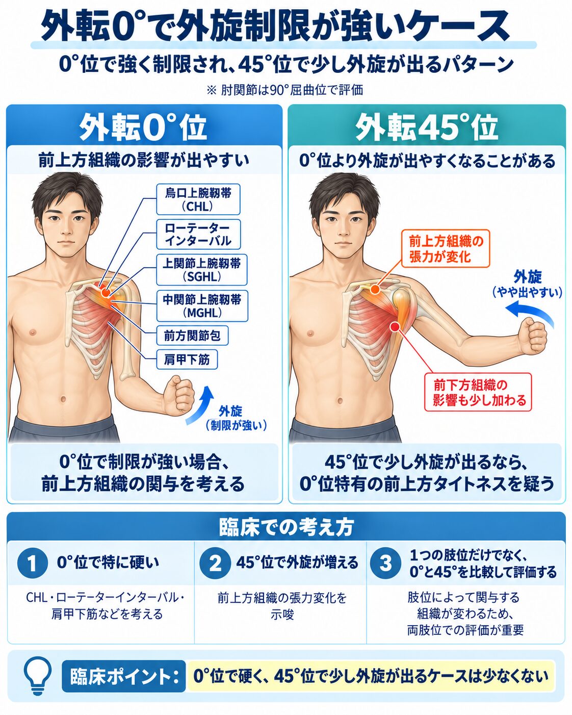 外転0°（下垂位）で外旋制限が強いケース