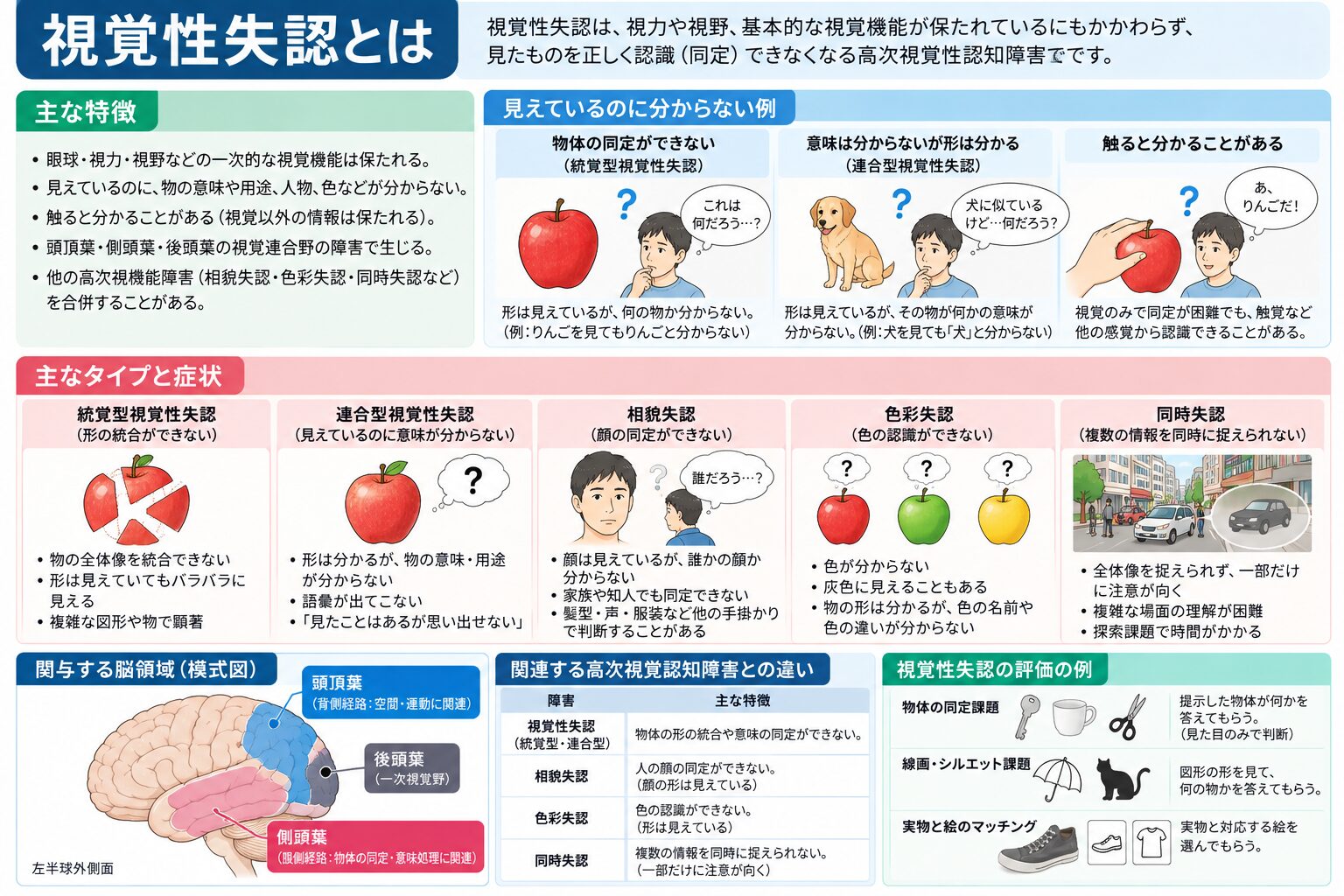 視覚性失認とは(統覚型・連合型などの視覚情報処理の段階)